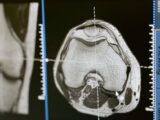 Close-up of an MRI scan displayed on a medical monitor, showcasing diagnostic medical imaging technology.